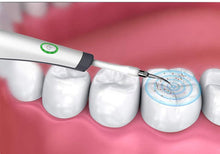 Luxury Tartar Remover - With 5 Attachments - Teeth Polishing - Water Flosser - Waterpik - Oral Irrigator - Water Floss