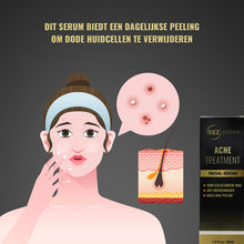 SEZGoods Acne Serum - Skincare - Acne Behandeling - Puisten Verwijderaar - Pigmentvlekken Verwijderen