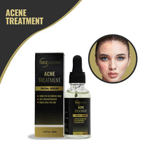 SEZGoods Acne Serum - Skincare - Acne Behandeling - Puisten Verwijderaar - Pigmentvlekken Verwijderen