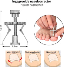 Professionele Pedicureset Met Nageltang & Nagelknipper Voor Ingegroeide Teennagel - 6-delig - Nagelbeugeltjes Ingegroeide Nagel - Teennagel Corrector - Bokkenpootje Nagels