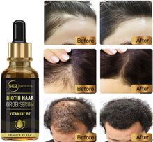 Haarserum – Haarwachstumsstimulator – Gegen Haarausfall – Haarwachstumsserum – Bartwachstumsprodukt – Bartwachstumsöl – Alternative zu Minoxidil 5 % 