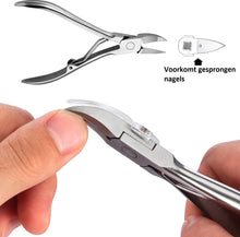 Professionele Pedicureset Met Nageltang & Nagelknipper Voor Ingegroeide Teennagel - 6-delig - Nagelbeugeltjes Ingegroeide Nagel - Teennagel Corrector - Bokkenpootje Nagels